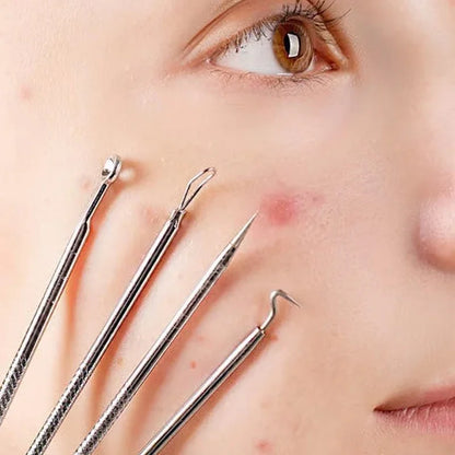 ClearSkin Blackhead Remover Tool