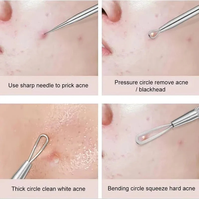 ClearSkin Blackhead Remover Tool