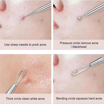 ClearSkin Blackhead Remover Tool