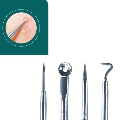 ClearSkin Blackhead Remover Tool
